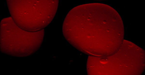 Diaporamas de la Soirée « Expositions Accidentelles à risque de transmission Virale »